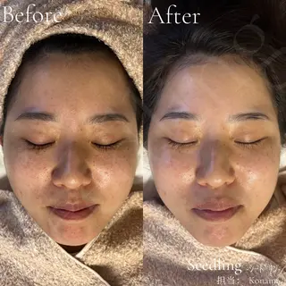 シードリン 府内店 小波のヘアスタイル