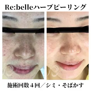 トータルビューティー サロンSalaのマツエク・マツパデザイン