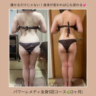 《本気痩せ×疲労改善 》  BILOOPのエステ・リラクイメージ