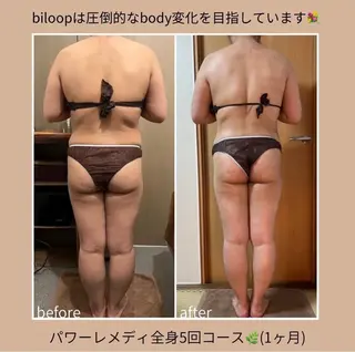 《本気痩せ×疲労改善 》  BILOOPのエステ・リラクイメージ