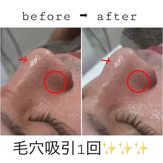 Lib Charm 北本結愛のエステ・リラクイメージ