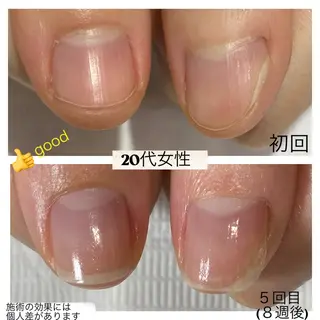 ネイル 自爪育成専門サロン エムロードゥ池下のネイルデザイン