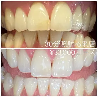 メンズ ホワイトニング ルーム　川崎店のその他イメージ