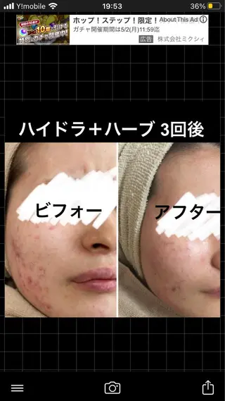 ミディアム カラー パーマ ヘアアレンジ メンズ キッズ ネイル マツエク・マツパ アイブロウ ハーブピーリング専門 🌿モッカのエステ・リラクイメージ