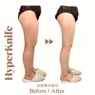 aimer 服部のその他イメージ