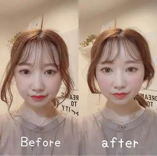 鍼灸 Refineのその他イメージ