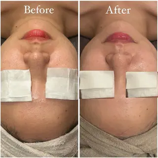 Tulipe Chihoのエステ・リラクイメージ