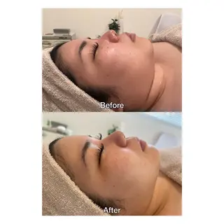 ROOM.S ｜脱毛｜美肌｜ボディのエステ・リラクイメージ