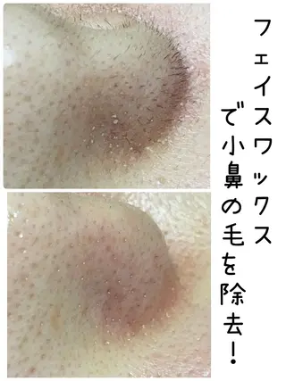 アイブロウ OUKA脱毛 毛穴ケアフェイシャルのエステ・リラクイメージ