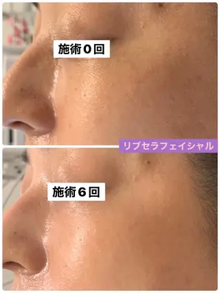 プライベートサロン プリュネルのエステ・リラクイメージ