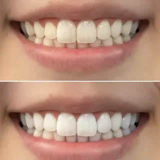 ホワイトニングサロン ダンブランシュサンダのエステ・リラクイメージ