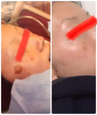 🏳️‍🌈 CHIYAKAのエステ・リラクイメージ