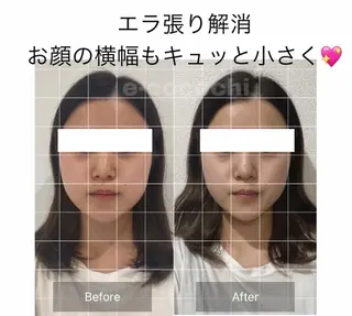 小顔と ヘッドスパのお店のエステ・リラクイメージ