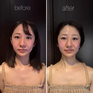 WINBACK salon　un agio所属・サロンドアンアージョ un agioのエステ・リラクイメージ