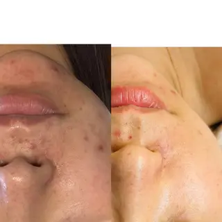 Beauty Zionのエステ・リラクイメージ