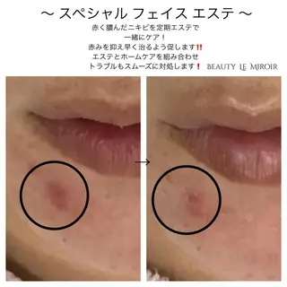 ビューティー ミロワールのエステ・リラクイメージ