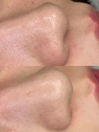 MA ORIの眉毛・アイブロウイメージ