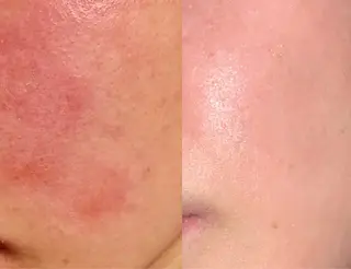 SKIN SKINのエステ・リラクイメージ