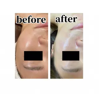 Beauty salonBellのエステ・リラクイメージ