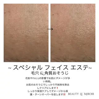 ビューティー ミロワールのエステ・リラクイメージ