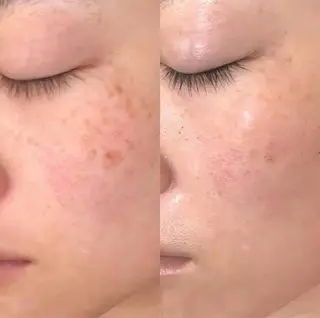 BISIN MEDICAL salon所属・BISIN MEDICALのエステ・リラクイメージ