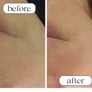 chou. chouのエステ・リラクイメージ