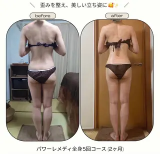 《本気痩せ×疲労改善 》  BILOOPのエステ・リラクイメージ