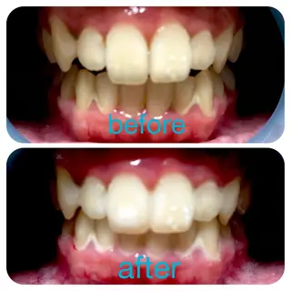 two nailのネイルデザイン