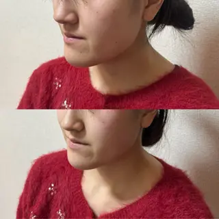 Amaranth所属・Lupinus 小顔矯正のエステ・リラクイメージ