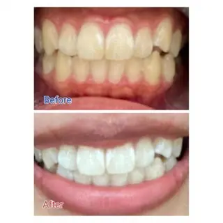 M渋谷 ホワイトニングのエステ・リラクイメージ