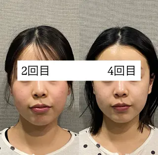 肌質改善専門 ハーブ /毛穴洗浄 リエイトのエステ・リラクイメージ