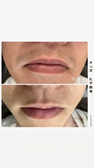 脱毛＆フェイシャル/ Rappore;増田のエステ・リラクイメージ