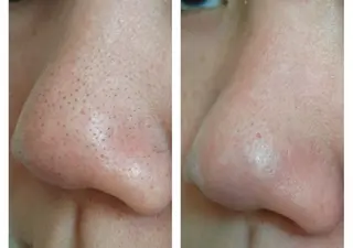 プライベートサロン LaLa 北山まいこのエステ・リラクイメージ