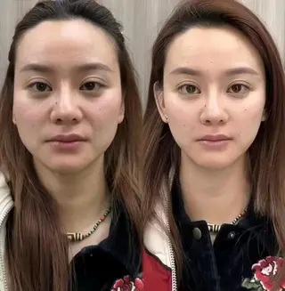 ネイル aliaハイフ&水光ジェットサロン所属・aliaハーブ水光店 エステティシャン募集のエステ・リラクイメージ