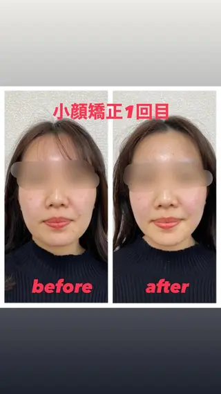 小顔矯正サロン Lilyのエステ・リラクイメージ