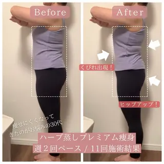 ハーブ蒸し小顔矯正 サロンLinoのエステ・リラクイメージ