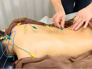 【美容鍼・小顔鍼】 鍼灸師　吉田洋美のエステ・リラクイメージ