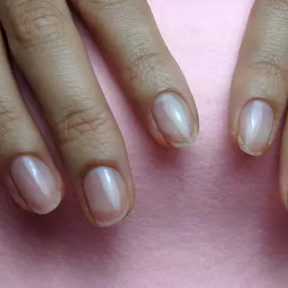 ネイル 深爪矯正/爪育成ケア manie nailのネイルデザイン