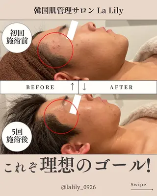韓国肌管理サロン La Lily 上田のエステ・リラクイメージ