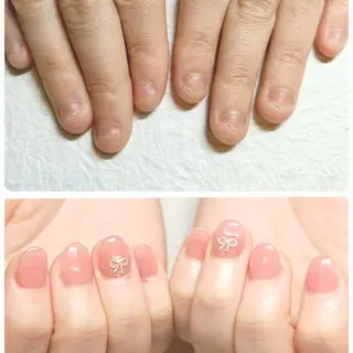 ネイル 深爪矯正/爪育成ケア manie nailのネイルデザイン