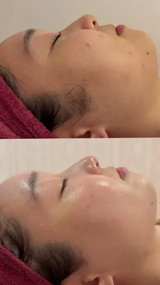 トータルビューティサロンアンジェリーク所属・アンジェリーク天神 美肌脱毛のエステ・リラクイメージ