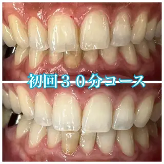ホワイトニング🦷 ネイル💅LEAのその他イメージ