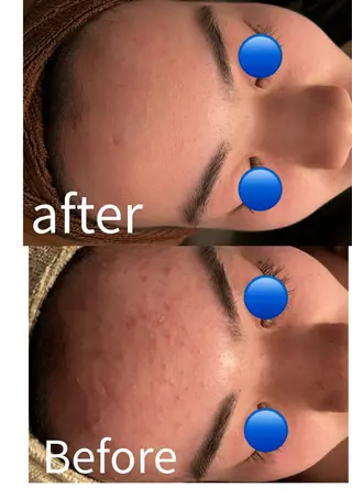 隠れ家フェイシャル&ドライヘッドケア新座所属・隠れ家フェイシャル＆ ドライヘッドケア新座のエステ・リラクイメージ