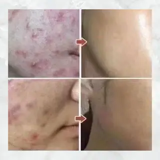 マツエク・マツパ 愛維美水光美肌専門店 メンズレディースokのエステ・リラクイメージ