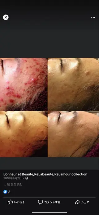 マツエク・マツパ 南森町 ceのマツエク・マツパデザイン