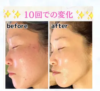 ポテンツァ&針美容 バストアップ専門店のエステ・リラクイメージ