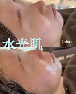 yukiko/美容師 肌質改善/中崎町のエステ・リラクイメージ