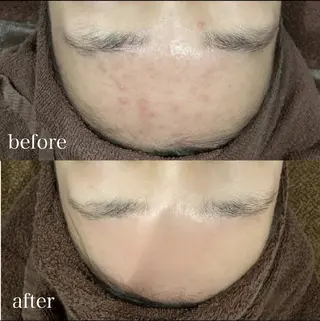 Dahlia痩身脱毛 フェイシャル 中村のエステ・リラクイメージ