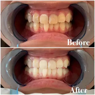 セミロング パーマ キッズ アイブロウ マツエク・マツパ メンズ カラー ヘアアレンジ ネイル ライトビューティー 銀座店のエステ・リラクイメージ