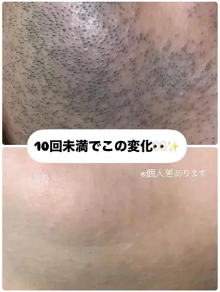 メンズ muumo所属・muumo まりののエステ・リラクイメージ